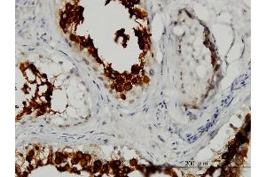 Immunoperoxidase of monoclonal antibody to ART3 on formalin-fixed paraffin-embedded human testis. (ART3 Antikörper  (AA 29-138))