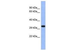 Image no. 1 for anti-Upstream Transcription Factor 1 (USF1) (C-Term) antibody (ABIN6742512) (USF1 Antikörper  (C-Term))