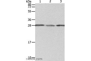 Western blot analysis of A549 cell, human liver cancer and fetal kidney tissue, using PSMD9 Polyclonal Antibody at dilution of 1:800 (PSMD9 Antikörper)