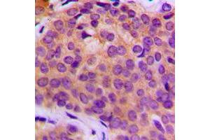 Immunohistochemistry (IHC) image for anti-Matrix Metallopeptidase 3 (Stromelysin 1, Progelatinase) (MMP3) (C-Term) antibody (ABIN7296314)