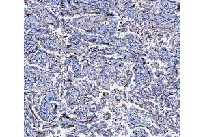IHC analysis of CD166/ALCAM using anti-CD166/ALCAM antibody (ABIN5518801).