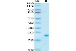 Human IL-10 on Tris-Bis PAGE under reduced condition. (IL-10 Protein (His-Avi Tag))