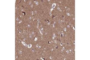 Immunohistochemical staining of human cerebral cortex with SGIP1 polyclonal antibody ( Cat # PAB28015 ) shows distinct cytoplasmic positivity in a fraction of neuronal cells at 1:10 - 1:20 dilution. (SGIP1 Antikörper)