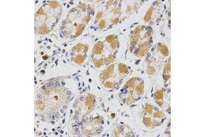 Immunohistochemistry (IHC) image for anti-Glutaredoxin 1 (GRX1) antibody (ABIN1876503) (Glutaredoxin 1 Antikörper)