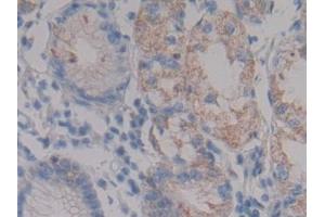 Detection of NPHN in Human Stomach Tissue using Polyclonal Antibody to Nephrin (NPHN) (Nephrin Antikörper  (AA 23-92))