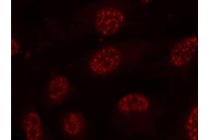 Immunofluorescence (IF) image for anti-Mitogen-Activated Protein Kinase-Activated Protein Kinase 2 (MAPKAPK2) (pThr334) antibody (ABIN1870393) (MAPKAP Kinase 2 Antikörper  (pThr334))