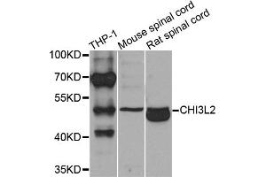 Western blot analysis of extracts of various cell lines, using CHI3L2 antibody (ABIN5975154) at 1/1000 dilution. (CHI3L2 Antikörper)