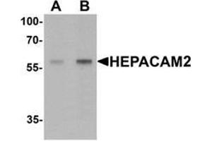 Western blot analysis of HEPACAM2 in mouse brain tissue lysate with HEPACAM2 Antibody  at (A) 0. (HEPACAM2 Antikörper  (C-Term))