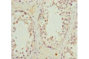 Immunohistochemistry of paraffin-embedded human testis tissue using ABIN7167215 at dilution of 1:100 (MRAS Antikörper  (AA 79-208))