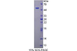 Image no. 1 for Peripheral-Type Benzodiazepine Receptor (TSPO) (AA 1-169) protein (His tag,GST tag) (ABIN6237266) (TSPO Protein (AA 1-169) (His tag,GST tag))