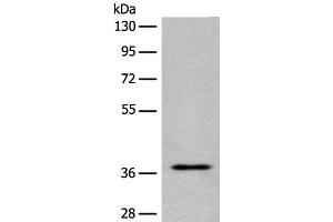 Western blot analysis of Jurkat cell lysate using EN2 Polyclonal Antibody at dilution of 1:400 (EN2 Antikörper)
