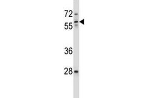 ICAM3 antibody western blot analysis in ZR-75-1 lysate. (ICAM-3/CD50 Antikörper  (AA 282-310))