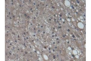 Immunohistochemistry (IHC) image for anti-Cytochrome P450, Family 3, Subfamily A, Polypeptide 7 (CYP3A7) (AA 344-497) antibody (ABIN7427744)