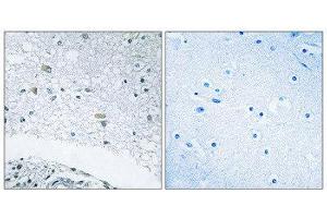 Immunohistochemistry (IHC) image for anti-Laminin, gamma 3 (LAMC3) (C-Term) antibody (ABIN1850460) (LAMC3 Antikörper  (C-Term))