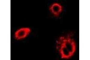 Immunofluorescent analysis of TCP1-delta staining in Hela cells. (CCT4 Antikörper)