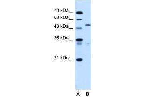 PODXL antibody used at 5 ug/ml to detect target protein. (PODXL Antikörper  (N-Term))