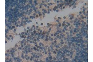 DAB staining on IHC-P; Samples: Mouse Spleen Tissue (Ki-67 Antikörper  (AA 2386-2674))