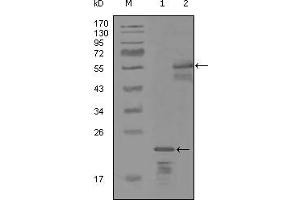 Western blot analysis using ERBB3 mouse mAb against truncated Trx-ERBB3 recombinant protein (1) and MBP-ERBB3 (aa1175-1275) recombinant protein (2). (ERBB3 Antikörper)