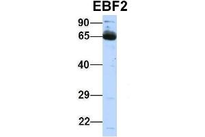 Host:  Rabbit  Target Name:  EBF2  Sample Type:  Human Fetal Lung  Antibody Dilution:  1. (EBF2 Antikörper  (Middle Region))