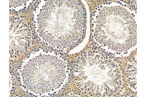 ABIN7096231 and ABIN7100293 at 1/100 staining rat testis tissue by IHC-P. (FAM83H Antikörper)