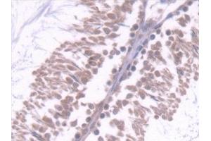 Immunohistochemistry (IHC) image for anti-CD7 (CD7) (AA 23-128) antibody (ABIN7444427)