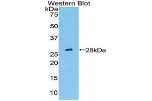 Western Blotting (WB) image for anti-Patched 1 (PTCH1) (AA 227-436) antibody (ABIN1860347) (Patched 1 Antikörper  (AA 227-436))