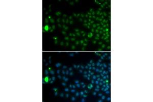 Immunofluorescence analysis of MCF-7 cells using SPDYA antibody. (SPDYA Antikörper)
