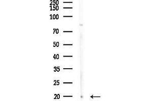 Western blot analysis of lysates from Mouse testis, using p18 INK4c Antibody at 1/1000 dilution.