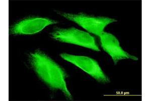 Immunofluorescence of monoclonal antibody to IL15 on HeLa cell. (IL-15 Antikörper  (AA 49-162))