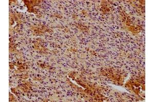 IHC image of ABIN7147134 diluted at 1:100 and staining in paraffin-embedded human spleen tissue performed on a Leica BondTM system. (CD19 Antikörper  (AA 20-291))