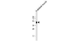 Anti-WNT11 Antibody (Center) at 1:2000 dilution + human skeletal muscle lysate Lysates/proteins at 20 μg per lane. (WNT11 Antikörper  (AA 166-198))