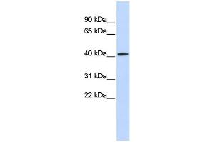WB Suggested Anti-PAntibody Titration:  0. (PARP11 Antikörper  (Middle Region))