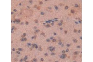 Used in DAB staining on fromalin fixed paraffin- embedded Kidney tissue (FZD1 Antikörper  (AA 112-317))