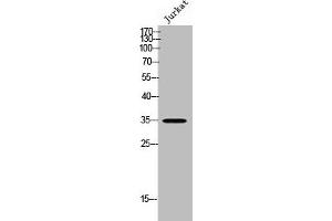Western Blot analysis of JK cells using OSR2 Polyclonal Antibody (OSR2 Antikörper  (Internal Region))