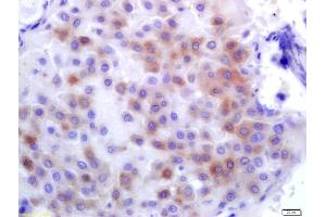 Formalin-fixed and paraffin embedded human placenta labeled with Anti-PLK1 Polyclonal Antibody, Unconjugated (ABIN700435) at 1:200 followed by conjugation to the secondary antibody and DAB staining (PLK1 Antikörper  (AA 201-300))