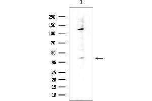 Western blot analysis of lysates from COLO205 cells(heat-shock treatment), using TAS2R8 Antibody at 1/1000 dilution.