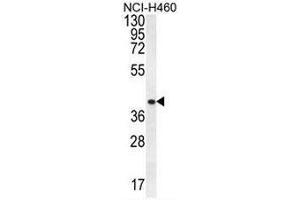 CCNYL3 Antibody (N-term) western blot analysis in NCI-H460 cell line lysates (35µg/lane). (CCNYL3 Antikörper  (N-Term))