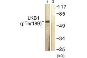 Western blot analysis of extracts from NIH-3T3 cells treated with PMA 125ng/ml 30', using LKB1 (Phospho-Thr189) Antibody. (LKB1 Antikörper  (pThr189))