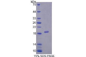 SDS-PAGE analysis of Human PCCa Protein.