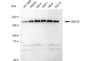 Western blotting analysis using BAZ1B antibody (ABIN7797797). (Rekombinanter BAZ1B Antikörper)