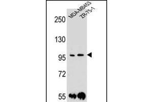 PCDH1 Antibody (N-term) (ABIN655958 and ABIN2845344) western blot analysis in MDA-M,ZR-75-1 cell line lysates (35 μg/lane). (Protocadherin 1 Antikörper  (N-Term))