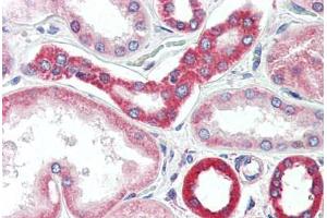 Human Kidney (formalin-fixed, paraffin-embedded) stained with BAK1 antibody ABIN461962 at 20 ug/ml followed by biotinylated goat anti-rabbit IgG secondary antibody ABIN481713, alkaline phosphatase-streptavidin and chromogen.