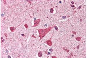 Human Brain, Cortex (formalin-fixed, paraffin-embedded) stained with TP53 antibody ABIN214388 at 2. (p53 Antikörper)