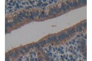 Detection of NB1 in Mouse Uterus Tissue using Polyclonal Antibody to Neutrophil Specific Antigen 1 (NB1) (CD177 Antikörper  (AA 193-468))
