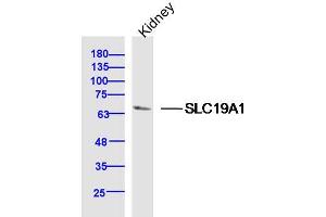 Mouse Kidney lysates probed with SLC19A1 Polyclonal Antibody, Unconjugated  at 1:300 dilution and 4˚C overnight incubation.