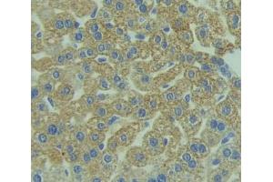 Used in DAB staining on fromalin fixed paraffin- embedded liver tissue (Reticulon 1 Antikörper  (AA 593-780))