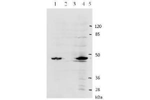 Western Blotting (WB) image for anti-Human Papilloma Virus Type 11 (HPV-11) (AA 83-201) antibody (ABIN781774) (Human Papilloma Virus Type 11 (HPV-11) (AA 83-201) Antikörper)