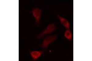ABIN6274304 staining HepG2 cells by IF/ICC. (RED1 Antikörper  (Internal Region))