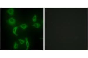 Immunofluorescence analysis of HepG2 cells, using IARS2 Antibody. (IARS2 Antikörper  (AA 71-120))