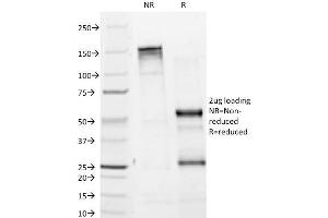 SDS-PAGE Analysis Purified Tyrosinase Monoclonal Antibody (T311). (TYR Antikörper)